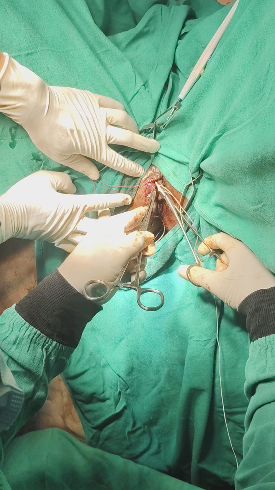 13-03-26 Anorectal_Surgery